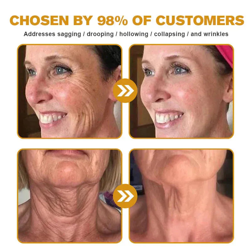 BeeRx™ Cream | Finally Break Free From The Endless Cycle of Failed Creams, Harsh Steroids & Empty Promises