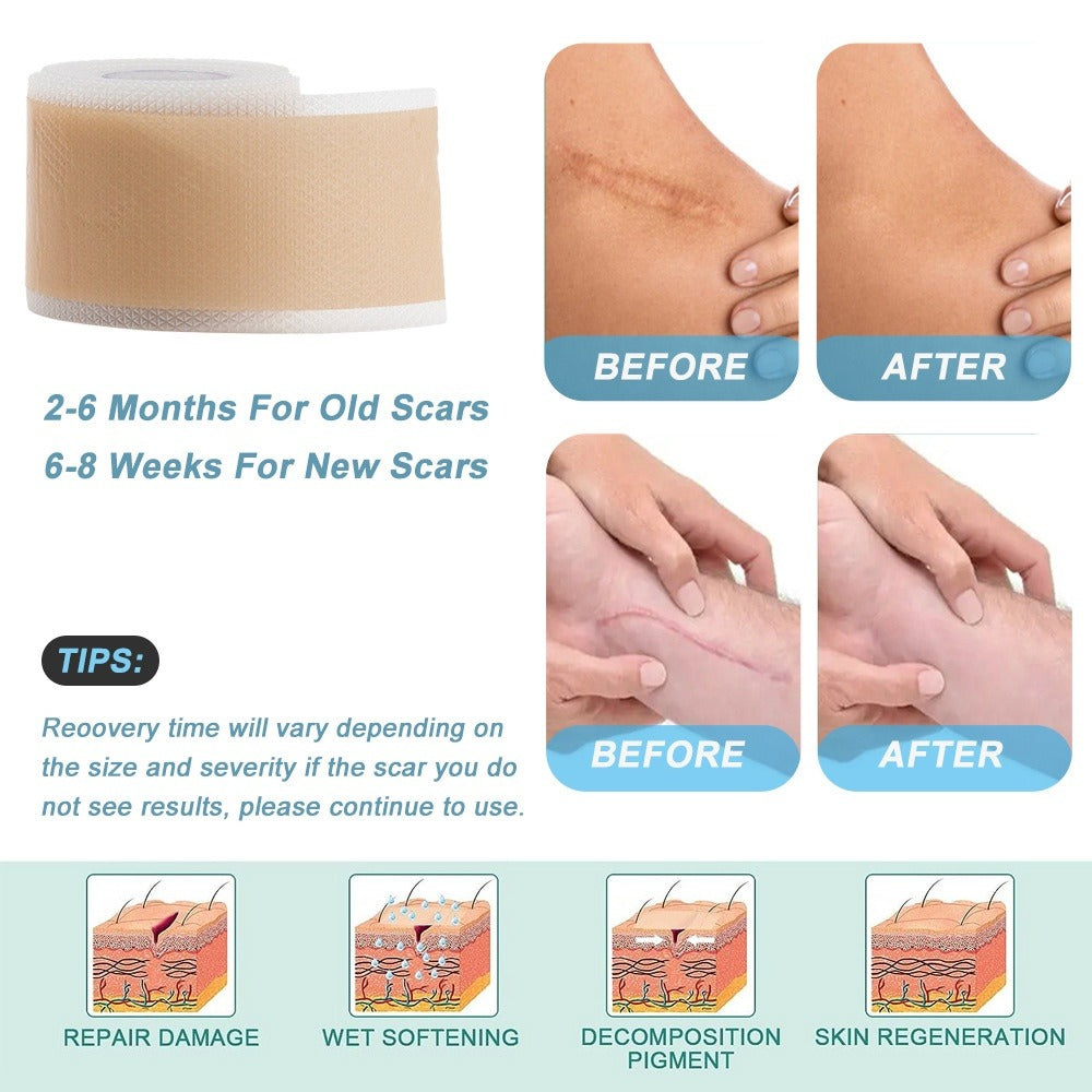 Silicone Gel Scar Relief Patch Csection