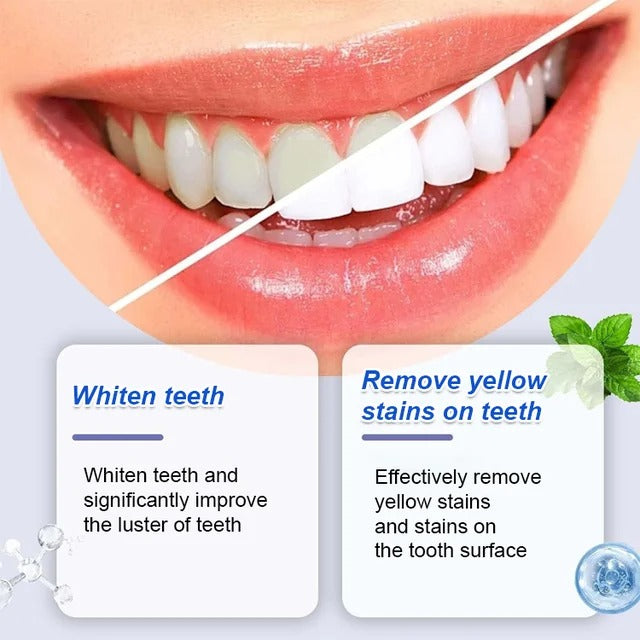 7.5% Nano-Hydroxyapatite Restorative Toothpaste